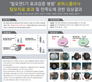 복합탈모치료는 대부분의 병원의 치료법이다